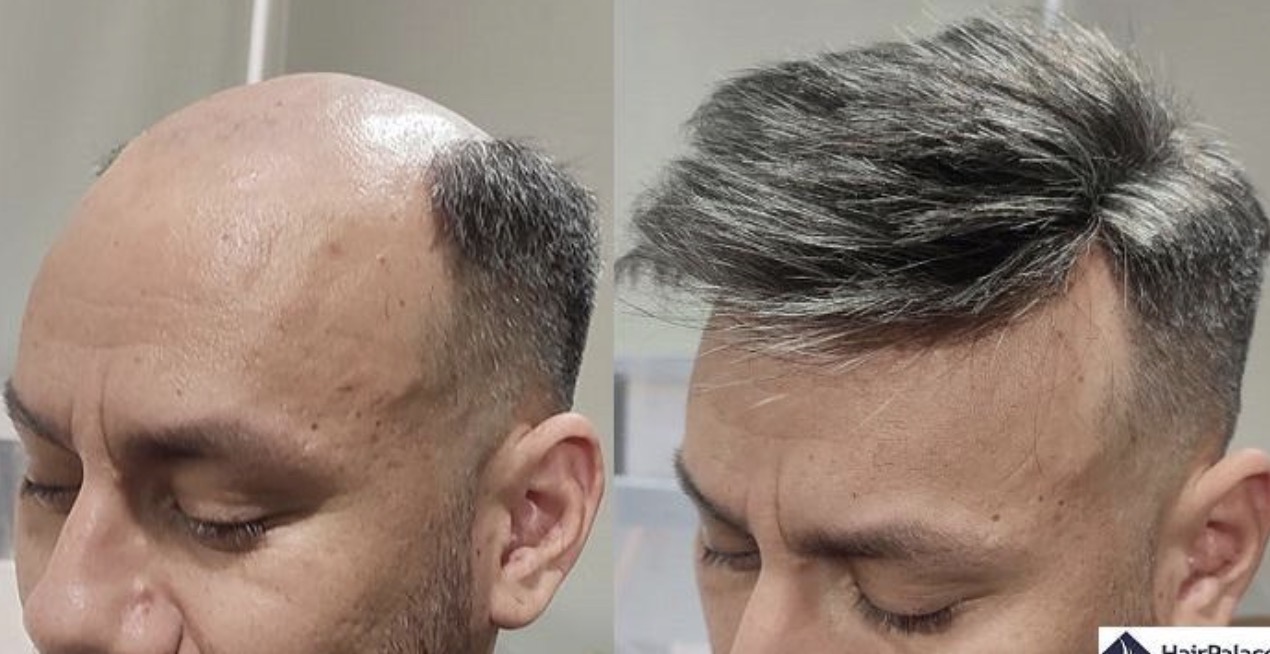 Hair Fixing