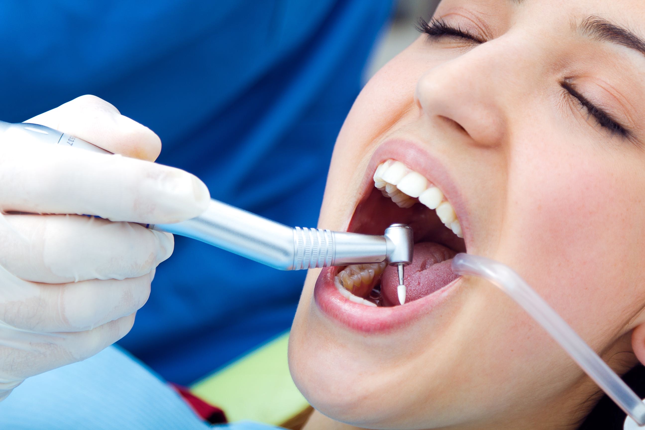 Teeth Cleaning & Scaling