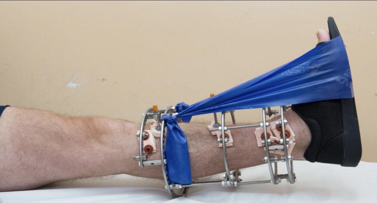 Fracture & Trauma Surgery