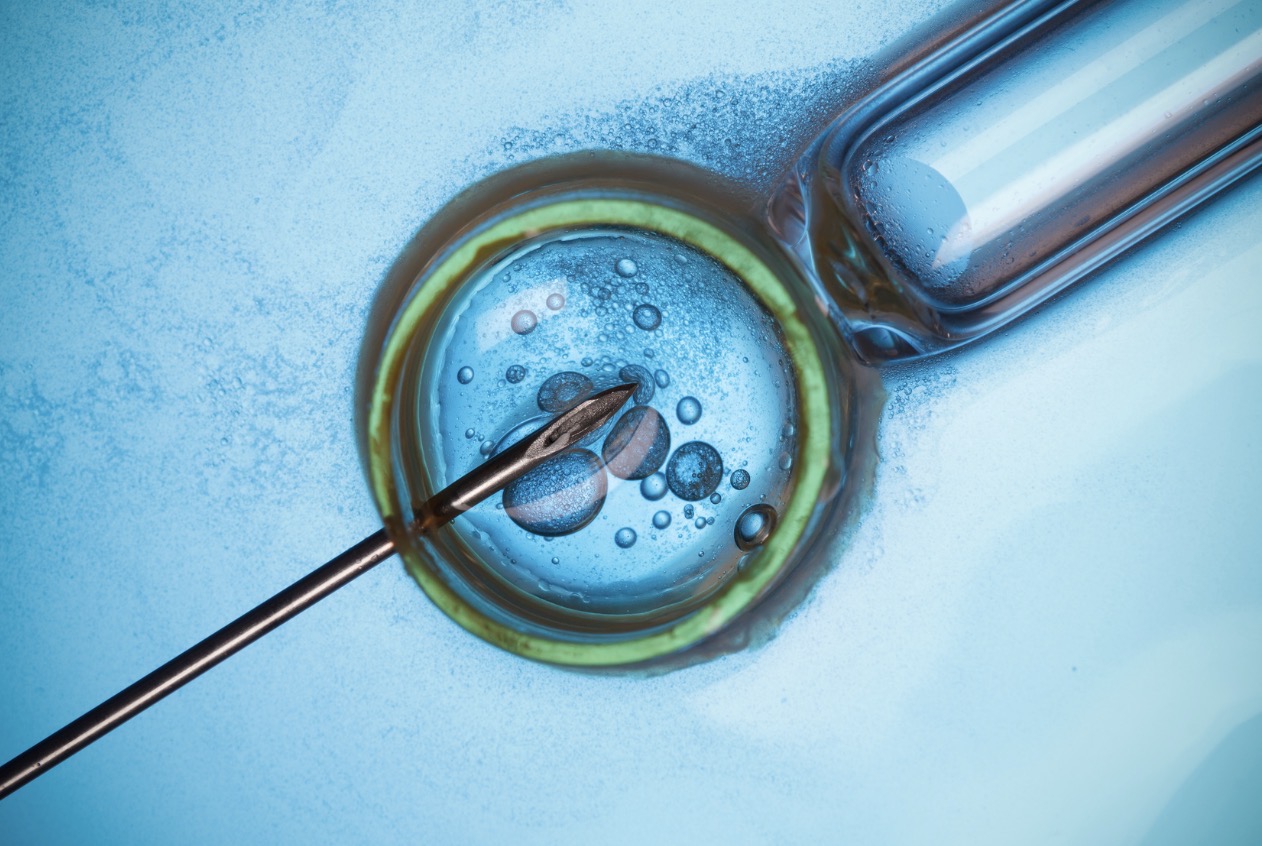 ICSI (Intracytoplasmic Sperm Injection)